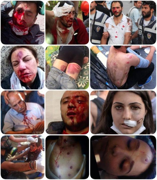 Police brutality - Turkey